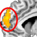 Is mentalism a part of psychology?