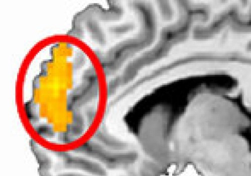 Is mentalism a part of psychology?